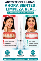 [HOY:33% OFF+ ENVÍO GRATIS] Elimina residuos donde el cepillo no alcanza